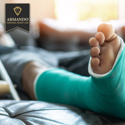 Close-up of an injured person resting with their leg in a green cast following an accident caused by negligence in Town 'n' Country, Florida
